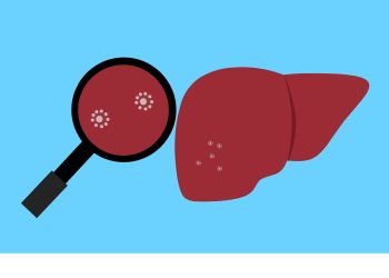 Protein ACSS2 odhalil slabinu jaterních metastáz