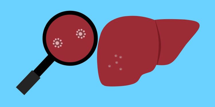 Protein ACSS2 odhalil slabinu jaterních metastáz